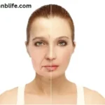 Featured image Face fat
